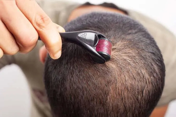 Microneedle Derma Roller 0.5mm for Men & Women – Hair Growth