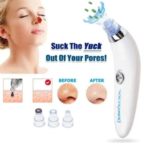Original 5 in 1 Derma Suction Blackhead Remover Machine